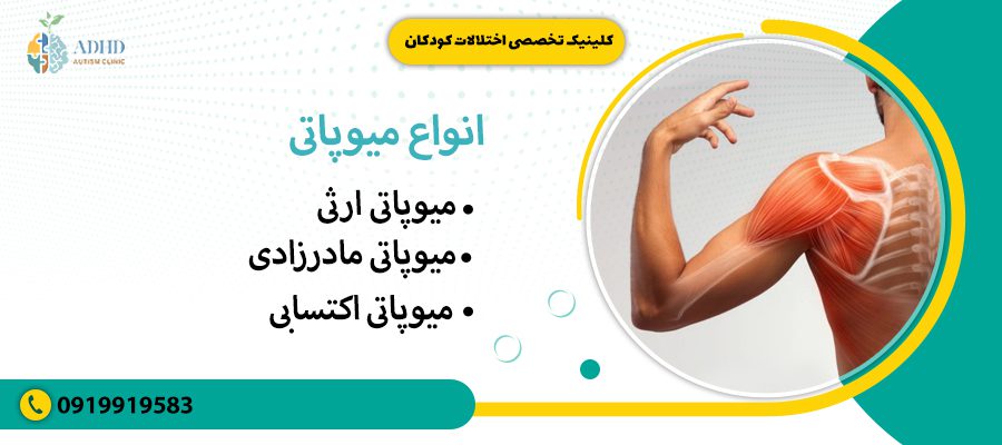 انواع میوپاتی